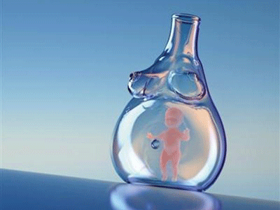 体外受精 IVF-ET